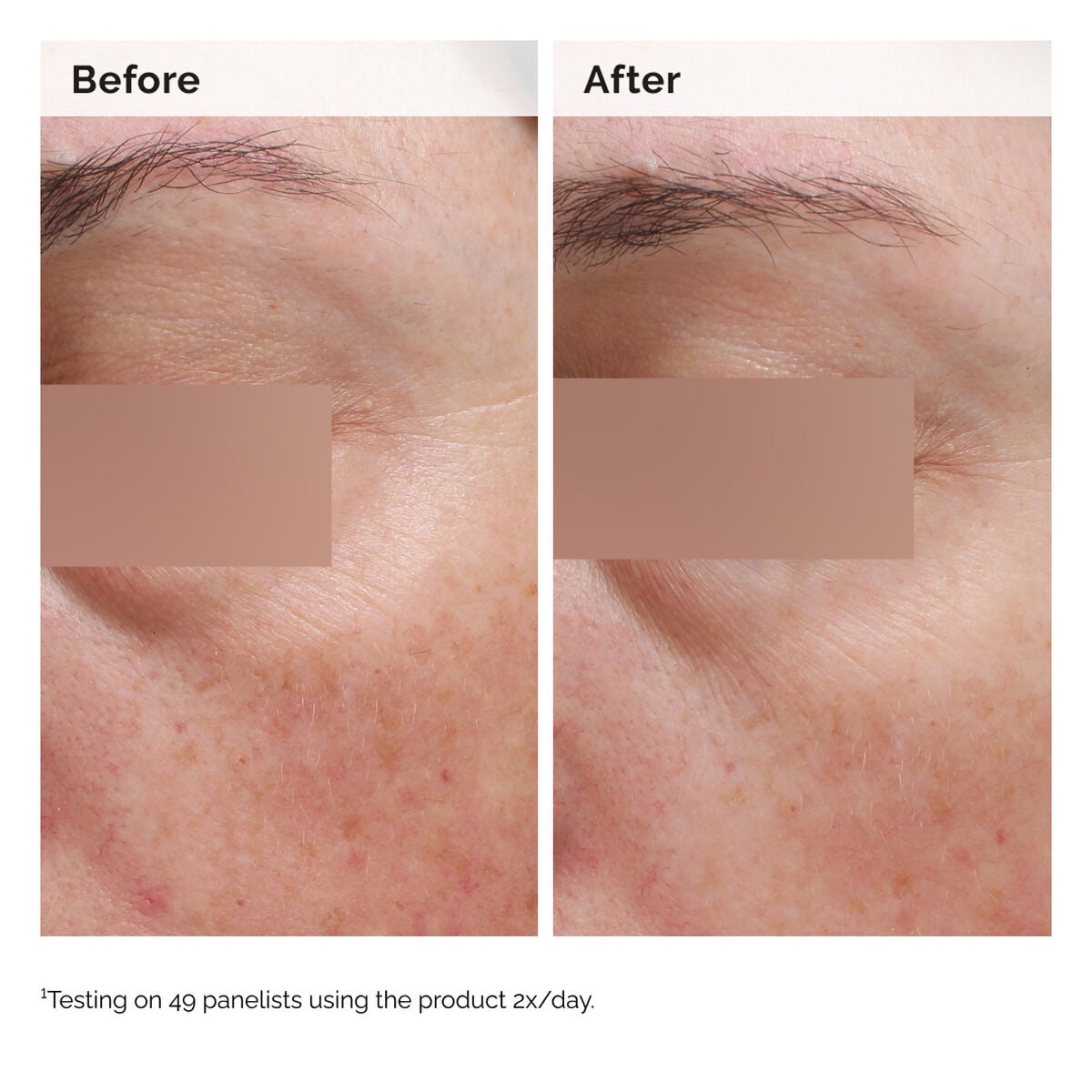 niacinamide-5-face-and-body-emulsion-y5 2024-08-23-ORD-Nia-5pct-Face-Body-B-A-Elasticity-Global-02-1x1.jpg