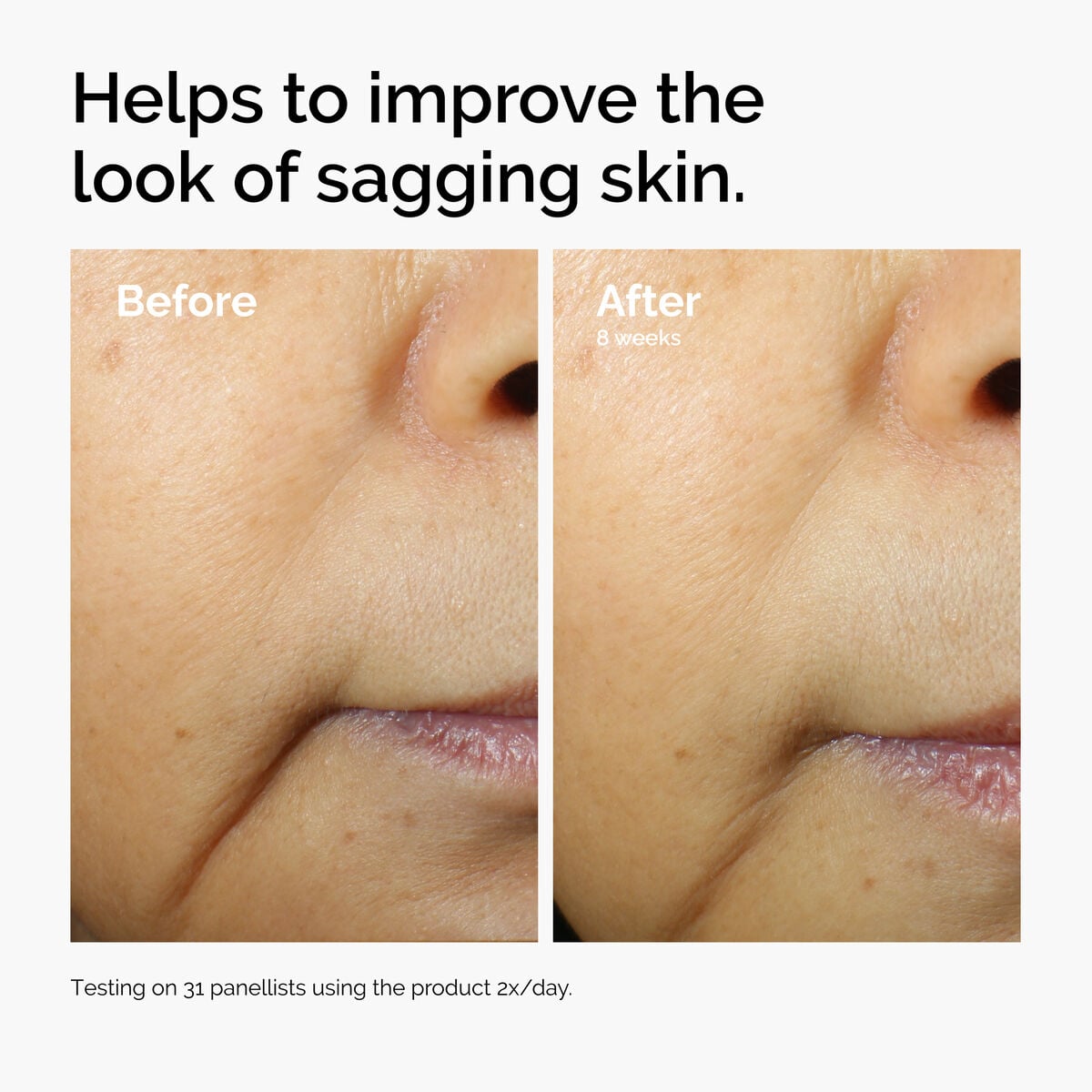 caffeine-3-escin-1-face-serum-d0 ord-caffeine-3pct-escin-1pct-face-serum-before-after-sagging.jpg