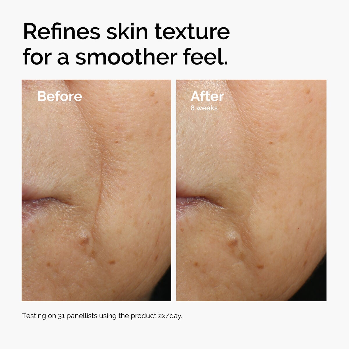 caffeine-3-escin-1-face-serum-d0 ord-caffeine-3pct-escin-1pct-face-serum-before-after-texture.jpg