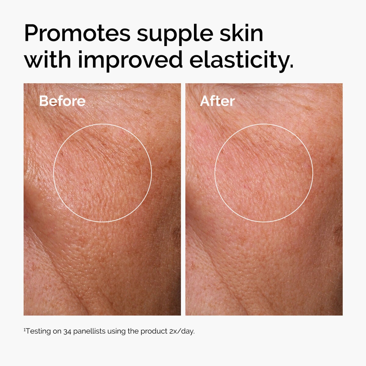hyaluronic-acid-2-b5-with-ceramides-n3 ord-hyaluronic-acid-2pct-b5-hydrating-serum-before-after-elasticity.jpg