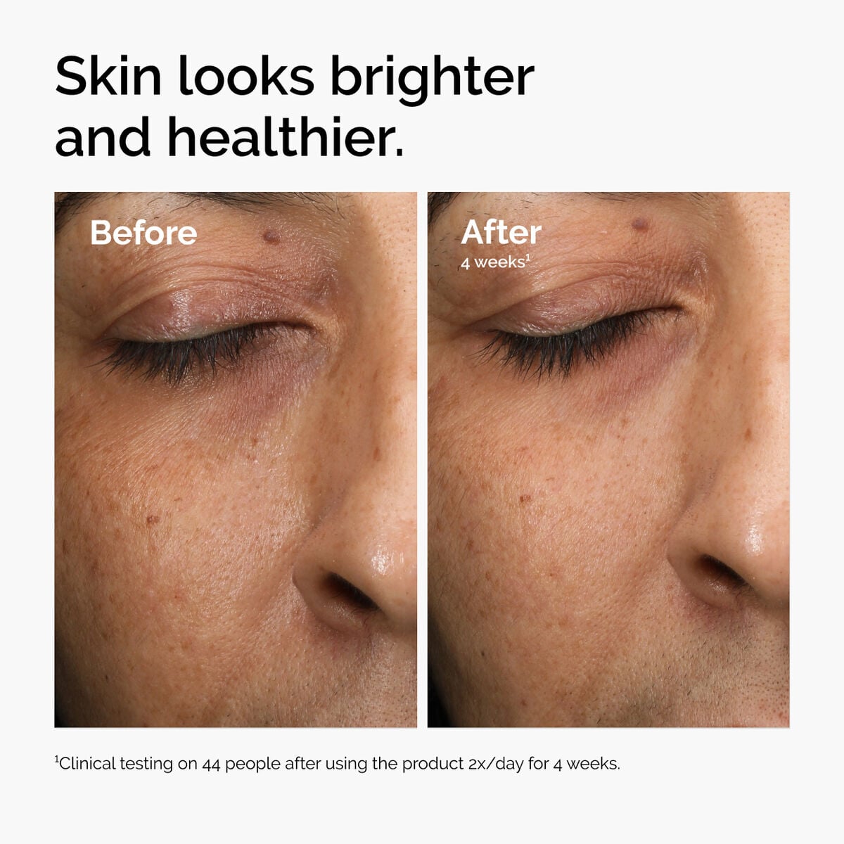 multi-antioxidant-radiance-serum-e2 ord-mars-before-after-healthy.jpg
