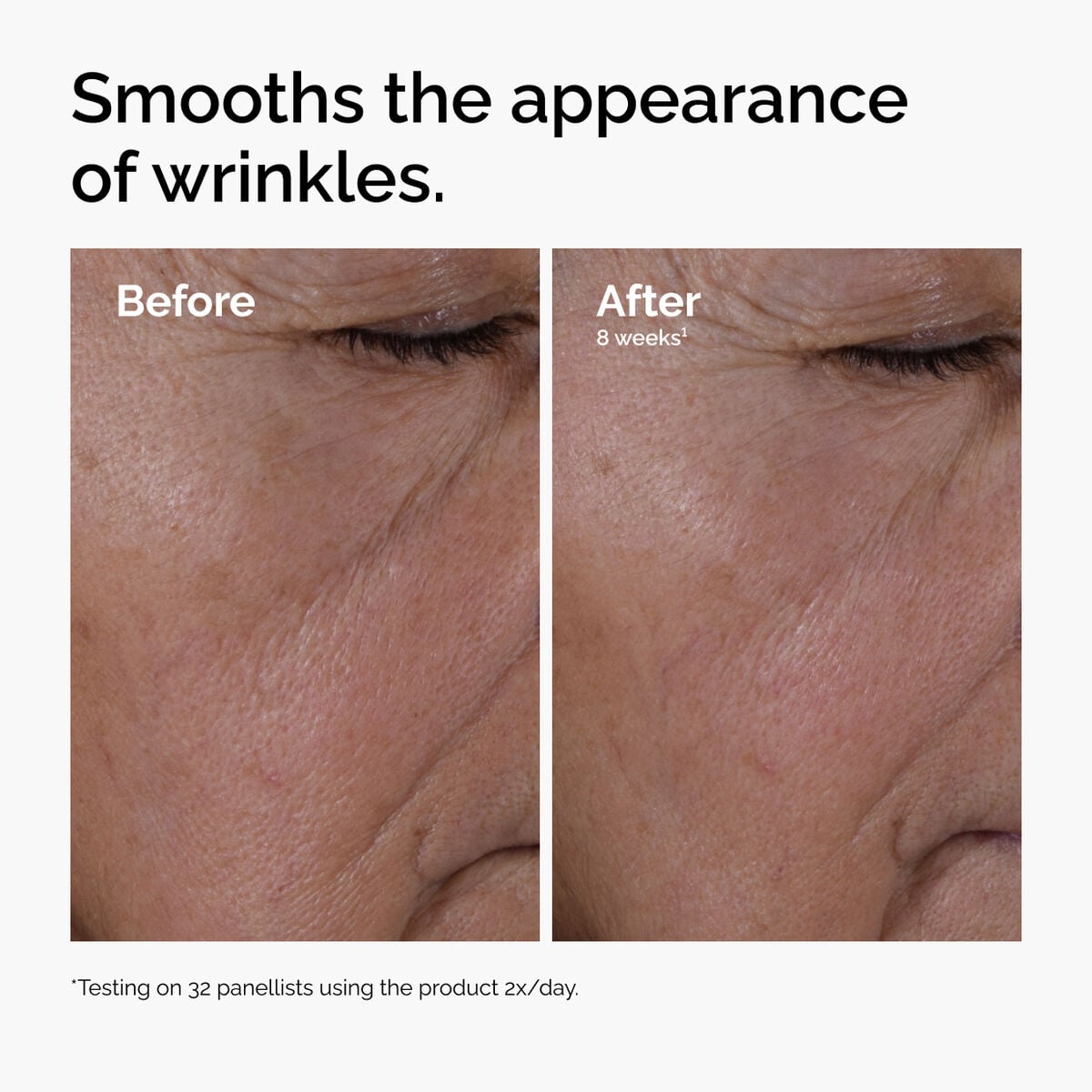 multi-peptide-ha-serum-p6 ord-multi-peptide-ha-serum-wrinkles-before-after.jpg