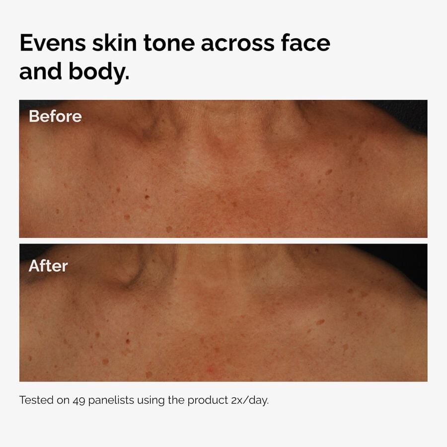 the-body-care-collection-r2 ord-niacinamide-face-body-serum-before-after-even-tone-graphic.jpg